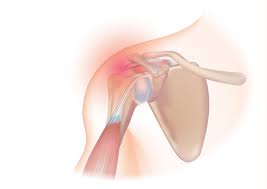 arthroscopy surgery in indore, shoulder arthroscopy surgery in indore