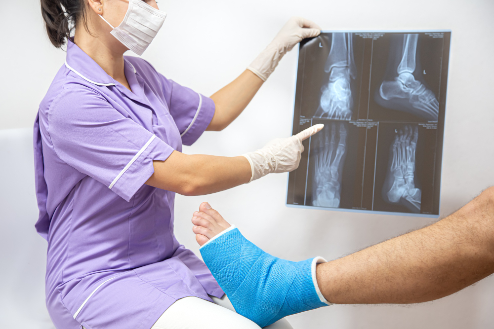 Types of bone fracture
