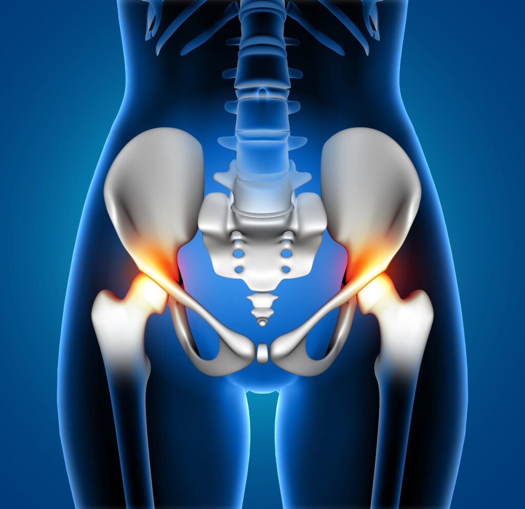Hip decompression surgery