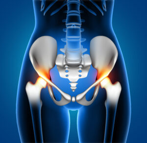 Hip decompression surgery