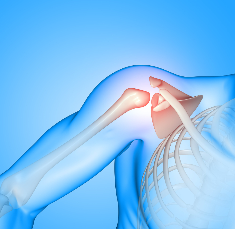 Orthopedic surgeon reviewing shoulder MRI scan before shoulder arthroscopy procedure in Indore