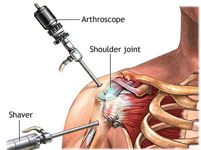 Orthopedic surgeon assessing a patient's shoulder range of motion during a consultation